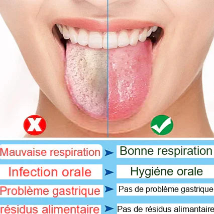 👅 Votre Bouche Cache des Bactéries Dangereuses… Éliminez-les IMMÉDIATEMENT !