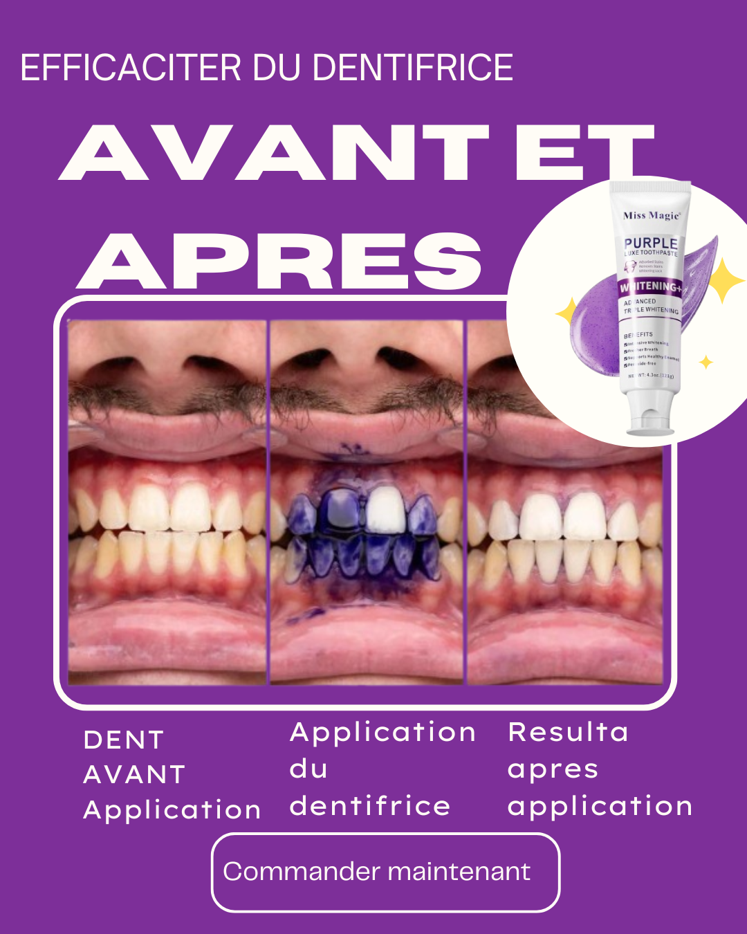 🟣 Miss Magic Purple – Dents Propres & Haleine Ultra Fraîche