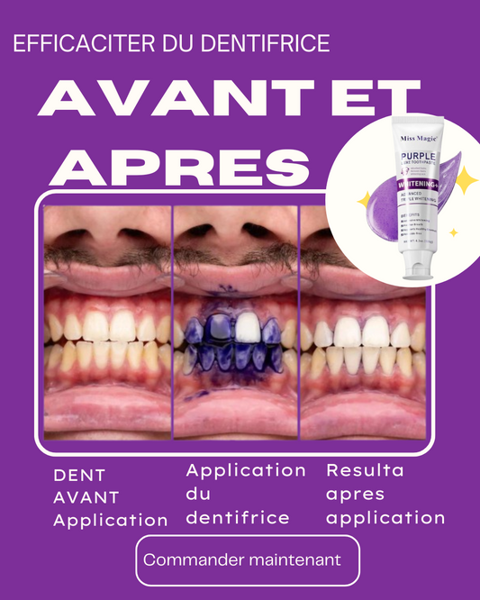 🟣 Miss Magic Purple – Dents Propres & Haleine Ultra Fraîche