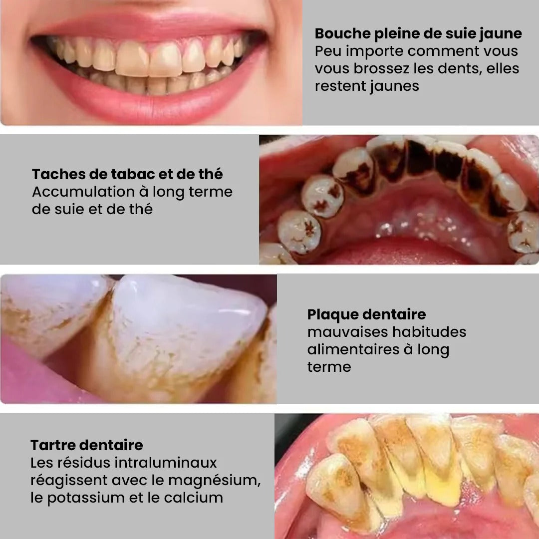 Pack Hygiène Totale 2-en-1 : Brosse à Dents Électrique + Détartreur Sonique + Miroir