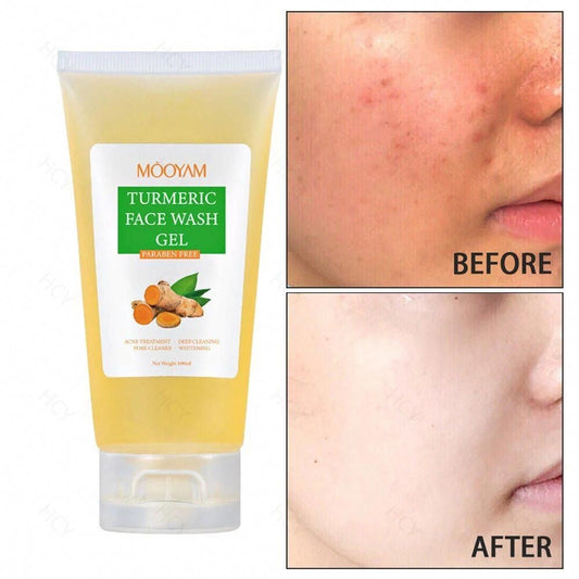 Gel Nettoyant Visage au Curcuma - Peau Éclatante & Sans Imperfections