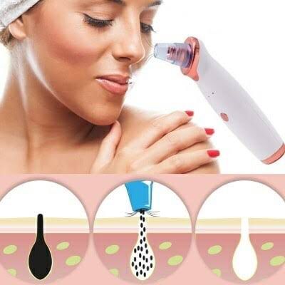 Extracteur de Points Noirs Professionnel
