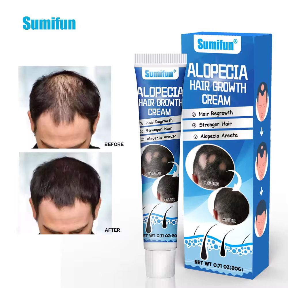 Alopécie Créme GB